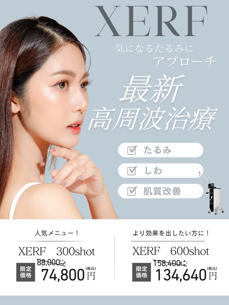 XERFキャンペーン