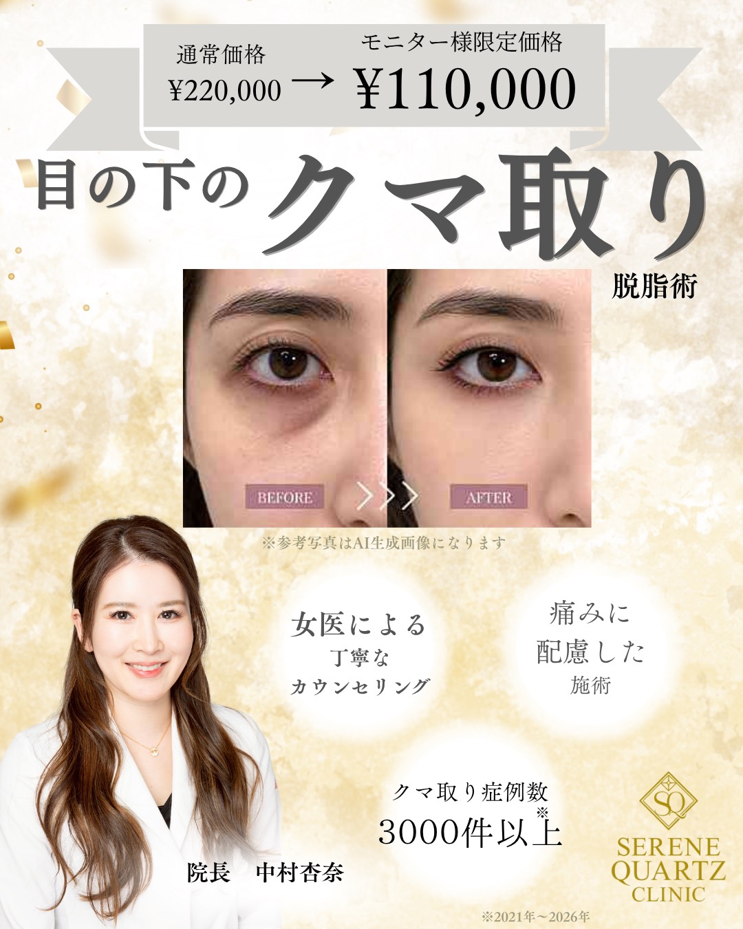 目の下のクマ取り（脱脂術）モニター募集